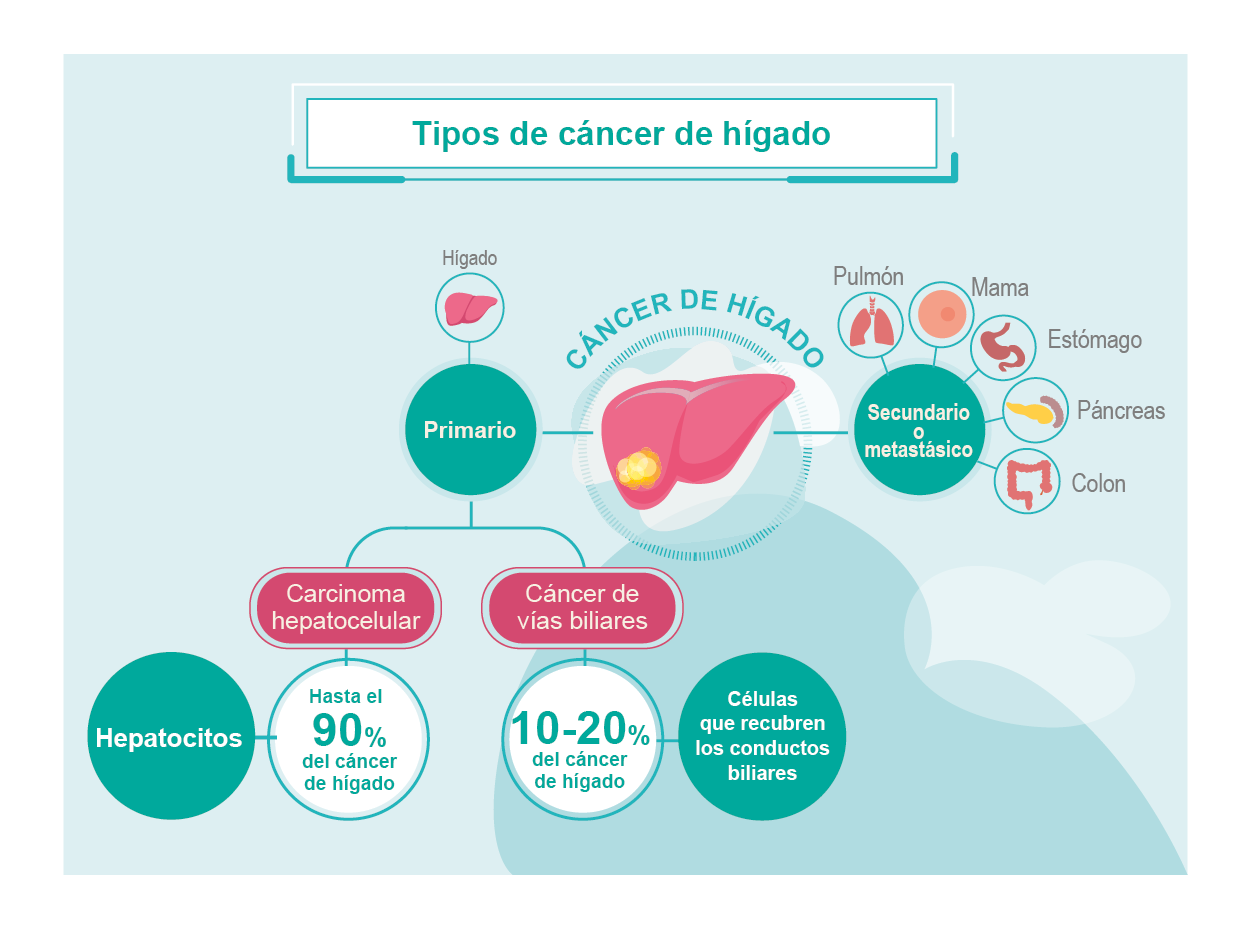 C Ncer De H Gado Qu Es Roche Pacientes